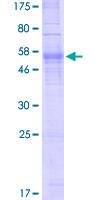 ab164358 on a 12.5% SDS-PAGE stained with Coomassie Blue.