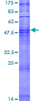 ab166424 on a 12.5% SDS-PAGE stained with Coomassie Blue.