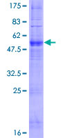 ab165300 on a 12.5% SDS-PAGE stained with Coomassie Blue.