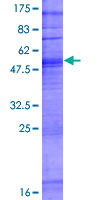 ab164321 on a 12.5% SDS-PAGE stained with Coomassie Blue.