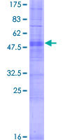 ab166547 on a 12.5% SDS-PAGE stained with Coomassie Blue.