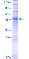 ab164229 on a 12.5% SDS-PAGE stained with Coomassie Blue.