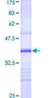 ab161705 on a 12.5% SDS-PAGE stained with Coomassie Blue.