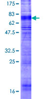 ab158648 on a 12.5% SDS-PAGE stained with Coomassie Blue.