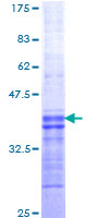 ab112299 analysed on a 12.5% SDS-PAGE Stained with Coomassie Blue.