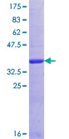 ab165051 on a 12.5% SDS-PAGE stained with Coomassie Blue.