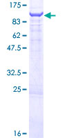 ab165052 on a 12.5% SDS-PAGE stained with Coomassie Blue.
