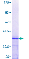 ab162284 on a 12.5% SDS-PAGE stained with Coomassie Blue.