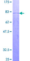 ab157992 on a 12.5% SDS-PAGE stained with Coomassie Blue.