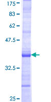 ab157993 on a 12.5% SDS-PAGE stained with Coomassie Blue.