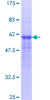 ab160370 on a 12.5% SDS-PAGE stained with Coomassie Blue.