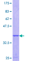 ab160371 on a 12.5% SDS-PAGE stained with Coomassie Blue.