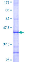 ab165327 on a 12.5% SDS-PAGE stained with Coomassie Blue.