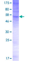 ab165873 on a 12.5% SDS-PAGE stained with Coomassie Blue.