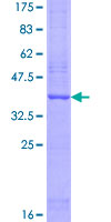 ab163686 on a 12.5% SDS-PAGE stained with Coomassie Blue.