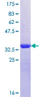 ab162184 on a 12.5% SDS-PAGE stained with Coomassie Blue.