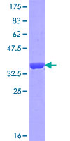 ab165527 on a 12.5% SDS-PAGE stained with Coomassie Blue.