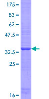 ab165370 on a 12.5% SDS-PAGE stained with Coomassie Blue.