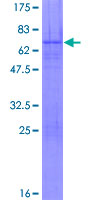 ab161647 on a 12.5% SDS-PAGE stained with Coomassie Blue.