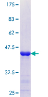 ab161648 on a 12.5% SDS-PAGE stained with Coomassie Blue.