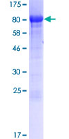 ab163135 on a 12.5% SDS-PAGE stained with Coomassie Blue.