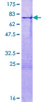 ab165276 on a 12.5% SDS-PAGE stained with Coomassie Blue.