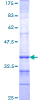 ab165277 on a 12.5% SDS-PAGE stained with Coomassie Blue.