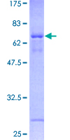 ab158304 on a 12.5% SDS-PAGE stained with Coomassie Blue.