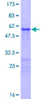 ab163682 on a 12.5% SDS-PAGE stained with Coomassie Blue.