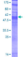 ab162111 on a 12.5% SDS-PAGE stained with Coomassie Blue.