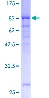 ab160727 on a 12.5% SDS-PAGE stained with Coomassie Blue.