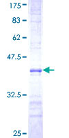 ab160728 on a 12.5% SDS-PAGE stained with Coomassie Blue.