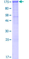 ab158078 on a 12.5% SDS-PAGE stained with Coomassie Blue.