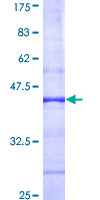 ab152652 on a 12.5% SDS-PAGE stained with Coomassie Blue.