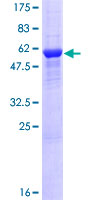 ab163008 on a 12.5% SDS-PAGE stained with Coomassie Blue.