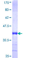 ab163009 on a 12.5% SDS-PAGE stained with Coomassie Blue.