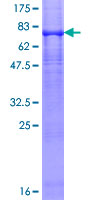 ab159040 on a 12.5% SDS-PAGE stained with Coomassie Blue.