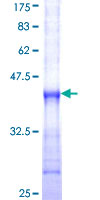 ab159041 on a 12.5% SDS-PAGE stained with Coomassie Blue.