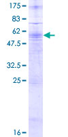 ab162147 on a 12.5% SDS-PAGE stained with Coomassie Blue.