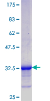 ab160422 on a 12.5% SDS-PAGE stained with Coomassie Blue.