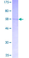 ab160222 on a 12.5% SDS-PAGE stained with Coomassie Blue.