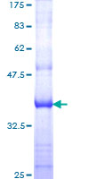 ab160223 on a 12.5% SDS-PAGE stained with Coomassie Blue.