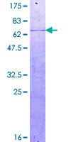 ab160274 on a 12.5% SDS-PAGE stained with Coomassie Blue.
