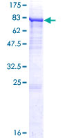 ab160278 on a 12.5% SDS-PAGE stained with Coomassie Blue.