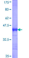 ab153320 on a 12.5% SDS-PAGE stained with Coomassie Blue.
