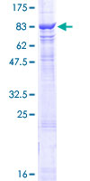 ab159962 on a 12.5% SDS-PAGE stained with Coomassie Blue.