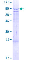 ab159431 on a 12.5% SDS-PAGE stained with Coomassie Blue.