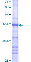 ab159432 on a 12.5% SDS-PAGE stained with Coomassie Blue.