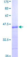 ab158995 on a 12.5% SDS-PAGE stained with Coomassie Blue.