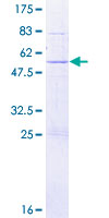 ab166282 on a 12.5% SDS-PAGE stained with Coomassie Blue.
